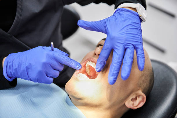 Best Root Canal Emergency Dentist  in Mount Sterling, OH